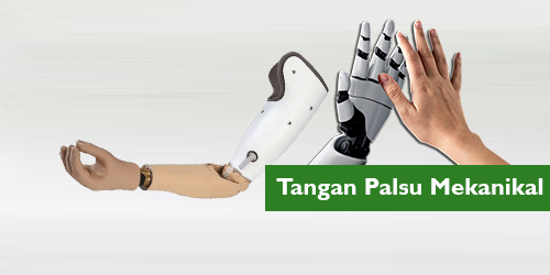 tangan palsu bawah siku